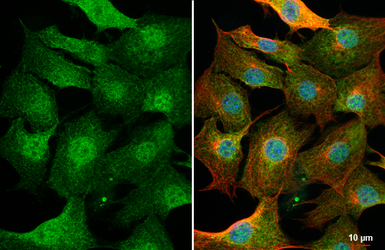 Anti-PIN1 antibody [HL2480] used in Immunocytochemistry/ Immunofluorescence (ICC/IF). GTX638829