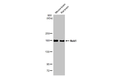Anti-Nek1 antibody [HL2489] used in Western Blot (WB). GTX638839