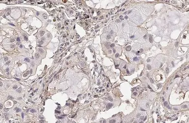 Anti-CD73 antibody [HL2493] used in IHC (Paraffin sections) (IHC-P). GTX638851