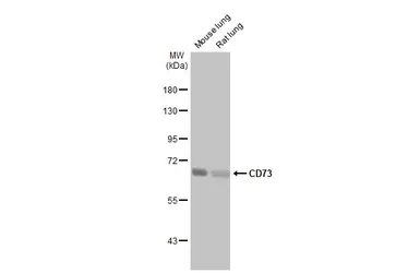 Anti-CD73 antibody [HL2493] used in Western Blot (WB). GTX638851