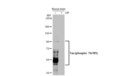 Anti-Tau (phospho Thr181) antibody [HL2497] used in Western Blot (WB). GTX638855