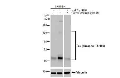 Anti-Tau (phospho Thr181) antibody [HL2498] used in Western Blot (WB). GTX638856