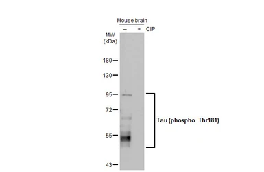 Anti-Tau (phospho Thr181) antibody [HL2498] used in Western Blot (WB). GTX638856