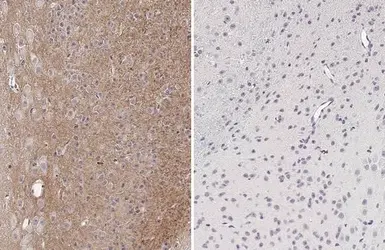 Anti-Tau (phospho Thr181) antibody [HL2498] used in IHC (Paraffin sections) (IHC-P). GTX638856