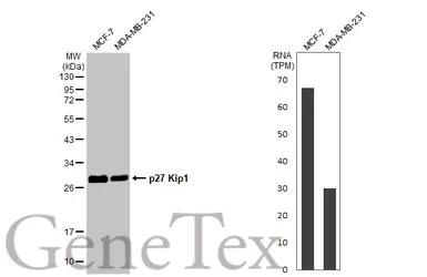 Anti-p27 Kip1 antibody [HL2508] used in Western Blot (WB). GTX638869