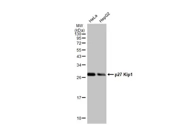 Anti-p27 Kip1 antibody [HL2508] used in Western Blot (WB). GTX638869