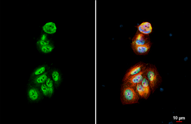 Anti-p27 Kip1 antibody [HL2508] used in Immunocytochemistry/ Immunofluorescence (ICC/IF). GTX638869