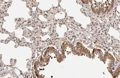 Anti-p27 Kip1 antibody [HL2508] used in IHC (Paraffin sections) (IHC-P). GTX638869