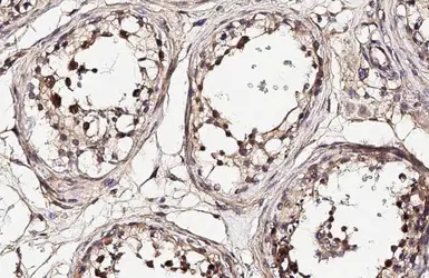 Anti-NEK2 antibody [HL2511] used in IHC (Paraffin sections) (IHC-P). GTX638872
