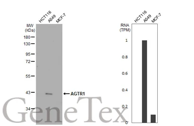 Anti-AGTR1 antibody [HL2526] used in Western Blot (WB). GTX638887