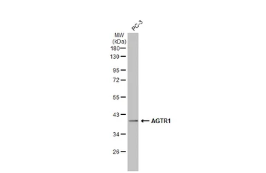 Anti-AGTR1 antibody [HL2526] used in Western Blot (WB). GTX638887