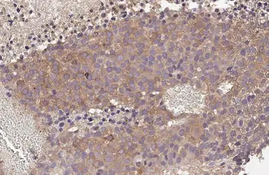 Anti-AGTR1 antibody [HL2526] used in IHC (Paraffin sections) (IHC-P). GTX638887