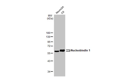 Anti-Nucleobindin 1 antibody [HL2532] used in Western Blot (WB). GTX638901
