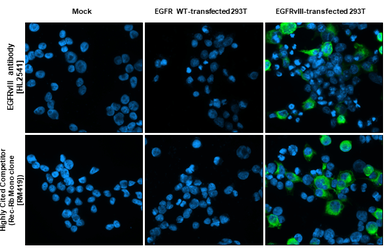Anti-EGFRvIII antibody [HL2541] used in Immunocytochemistry/ Immunofluorescence (ICC/IF). GTX638910