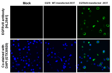 Anti-EGFRvIII antibody [HL2541] used in IHC-P (cell pellet) (IHC-P (cell pellet)). GTX638910