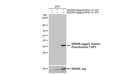 Anti-Human Parechovirus 3 VP3 antibody [HL2544] used in Western Blot (WB). GTX638913