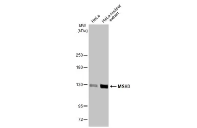 Anti-MSH3 antibody [HL2546] used in Western Blot (WB). GTX638918
