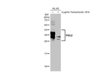 Anti-PRG2 antibody [HL2547] used in Western Blot (WB). GTX638919