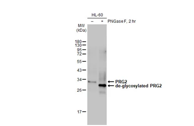Anti-PRG2 antibody [HL2547] used in Western Blot (WB). GTX638919