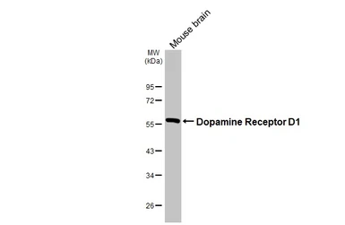 Anti-Dopamine Receptor D1 antibody [HL2553] used in Western Blot (WB). GTX638925