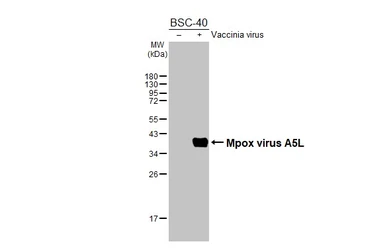 Anti-Mpox virus A5L antibody [HL2555] used in Western Blot (WB). GTX638927