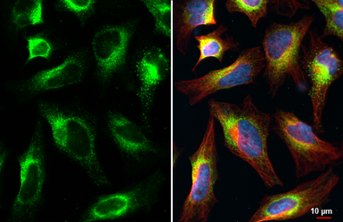 Anti-CKAP4 antibody [HL2562] used in Immunocytochemistry/ Immunofluorescence (ICC/IF). GTX638940