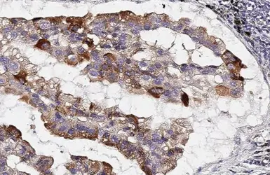 Anti-CKAP4 antibody [HL2562] used in IHC (Paraffin sections) (IHC-P). GTX638940
