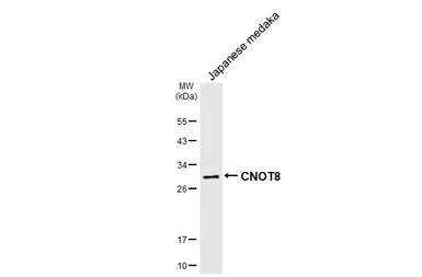 Anti-CNOT8 antibody [HL2586] used in Western Blot (WB). GTX639037