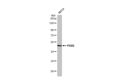 Anti-PAX6 antibody [HL2599] used in Western Blot (WB). GTX639051