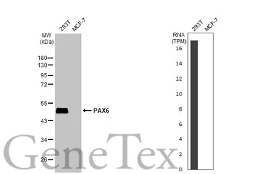 Anti-PAX6 antibody [HL2599] used in Western Blot (WB). GTX639051