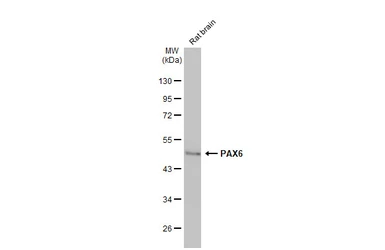 Anti-PAX6 antibody [HL2599] used in Western Blot (WB). GTX639051