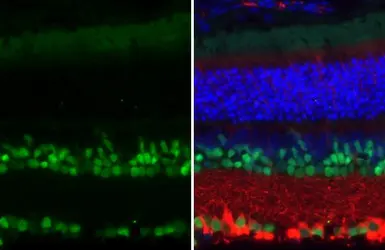 Anti-PAX6 antibody [HL2599] used in IHC (Paraffin sections) (IHC-P). GTX639051