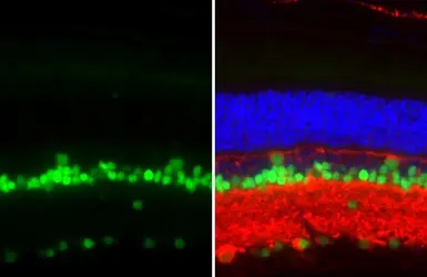 Anti-PAX6 antibody [HL2599] used in IHC (Paraffin sections) (IHC-P). GTX639051