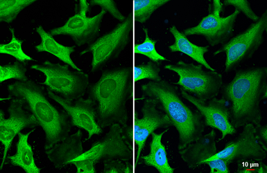 Anti-LDHA antibody [HL2615] used in Immunocytochemistry/ Immunofluorescence (ICC/IF). GTX639069