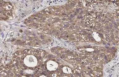 Anti-LDHA antibody [HL2615] used in IHC (Paraffin sections) (IHC-P). GTX639069