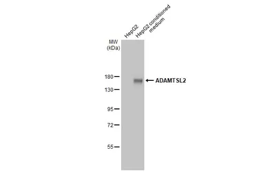 Anti-ADAMTSL2 antibody [HL2616] used in Western Blot (WB). GTX639070