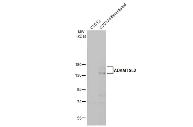 Anti-ADAMTSL2 antibody [HL2616] used in Western Blot (WB). GTX639070