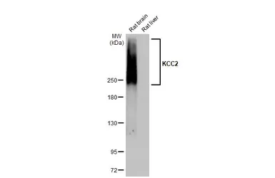 Anti-KCC2 antibody [HL2625] used in Western Blot (WB). GTX639081