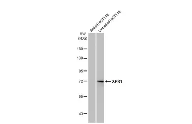 Anti-XPR1 antibody [HL2632] used in Western Blot (WB). GTX639088