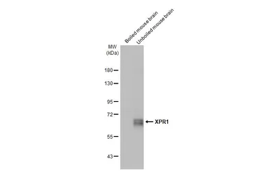 Anti-XPR1 antibody [HL2632] used in Western Blot (WB). GTX639088