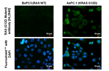 Anti-RAS (G12D Mutant) antibody [HL2640] used in Immunocytochemistry/ Immunofluorescence (ICC/IF). GTX639096