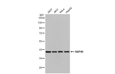 Anti-HAP40 antibody [HL2642] used in Western Blot (WB). GTX639098