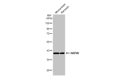Anti-HAP40 antibody [HL2642] used in Western Blot (WB). GTX639098