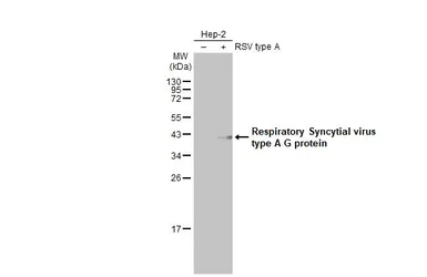 Anti-Respiratory Syncytial virus type A G protein antibody [HL2643] used in Western Blot (WB). GTX639099