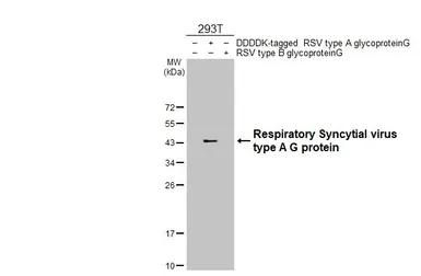 Anti-Respiratory Syncytial virus type A G protein antibody [HL2643] used in Western Blot (WB). GTX639099