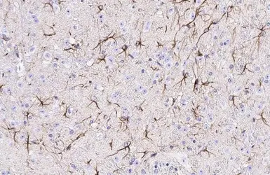 Anti-EphA3 antibody [HL2651] used in IHC (Paraffin sections) (IHC-P). GTX639110