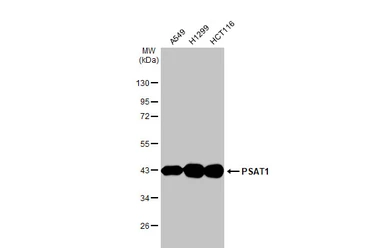 Anti-PSAT1 antibody [HL2663] used in Western Blot (WB). GTX639327