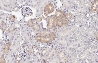 Anti-PSAT1 antibody [HL2663] used in IHC (Paraffin sections) (IHC-P). GTX639327