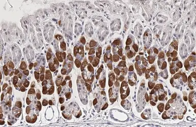 Anti-PCSK9 antibody [HL2666] used in IHC (Paraffin sections) (IHC-P). GTX639330