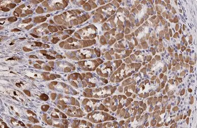 Anti-PCSK9 antibody [HL2666] used in IHC (Paraffin sections) (IHC-P). GTX639330